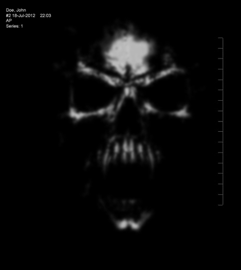 X-Ray of John Doe (Dracula)